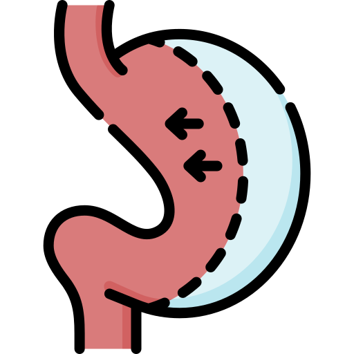 Bariatric Surgery